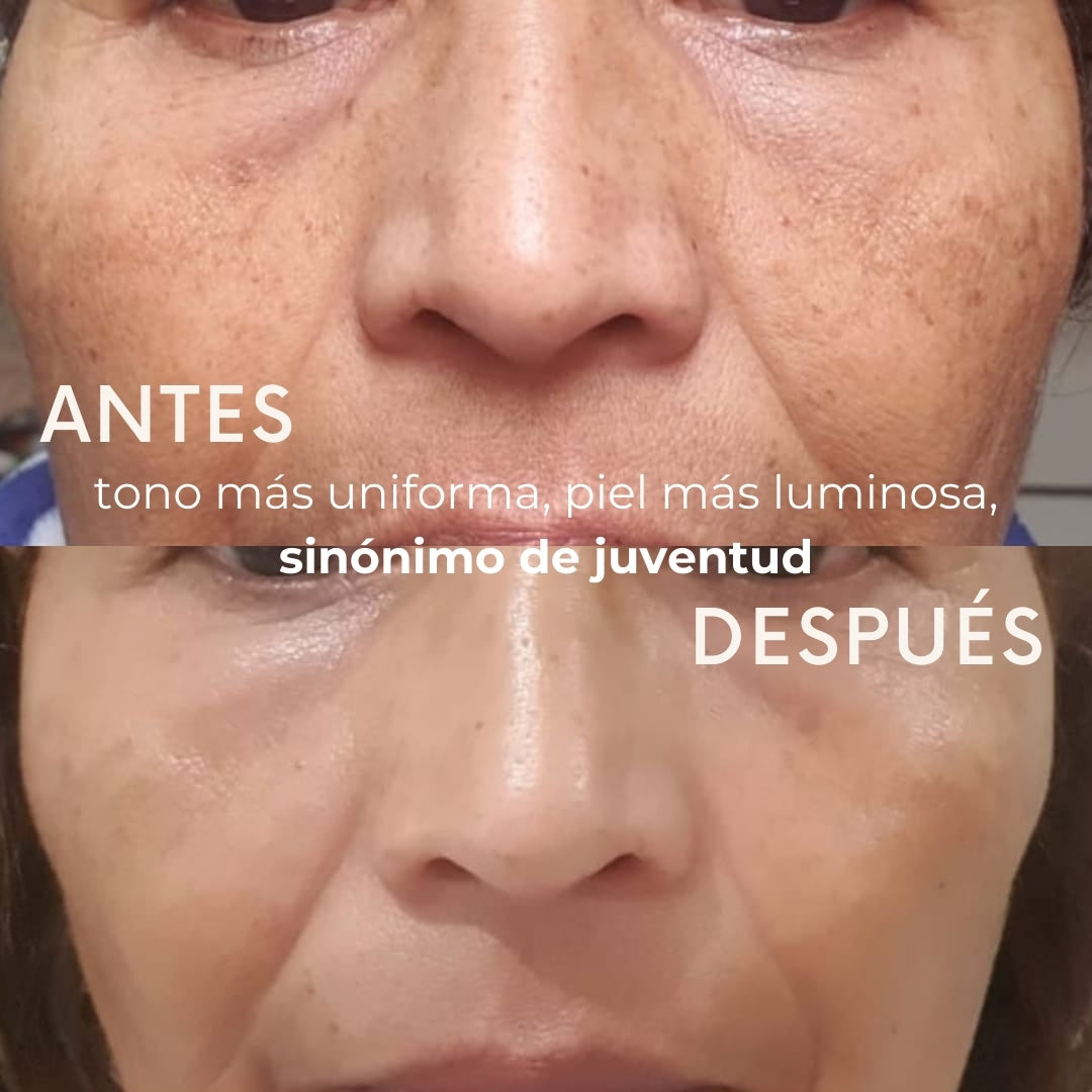 ¡Resaltará la belleza que vive en ti! 2 productos con 15 beneficios antiedad y antimanchas. 
Una rutina sencilla que te ayudará a nutrir, hidratar, proteger y fortalecer la barrera protectora de tu piel.