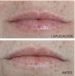 âmebalm, bálsamo y mascarilla labial