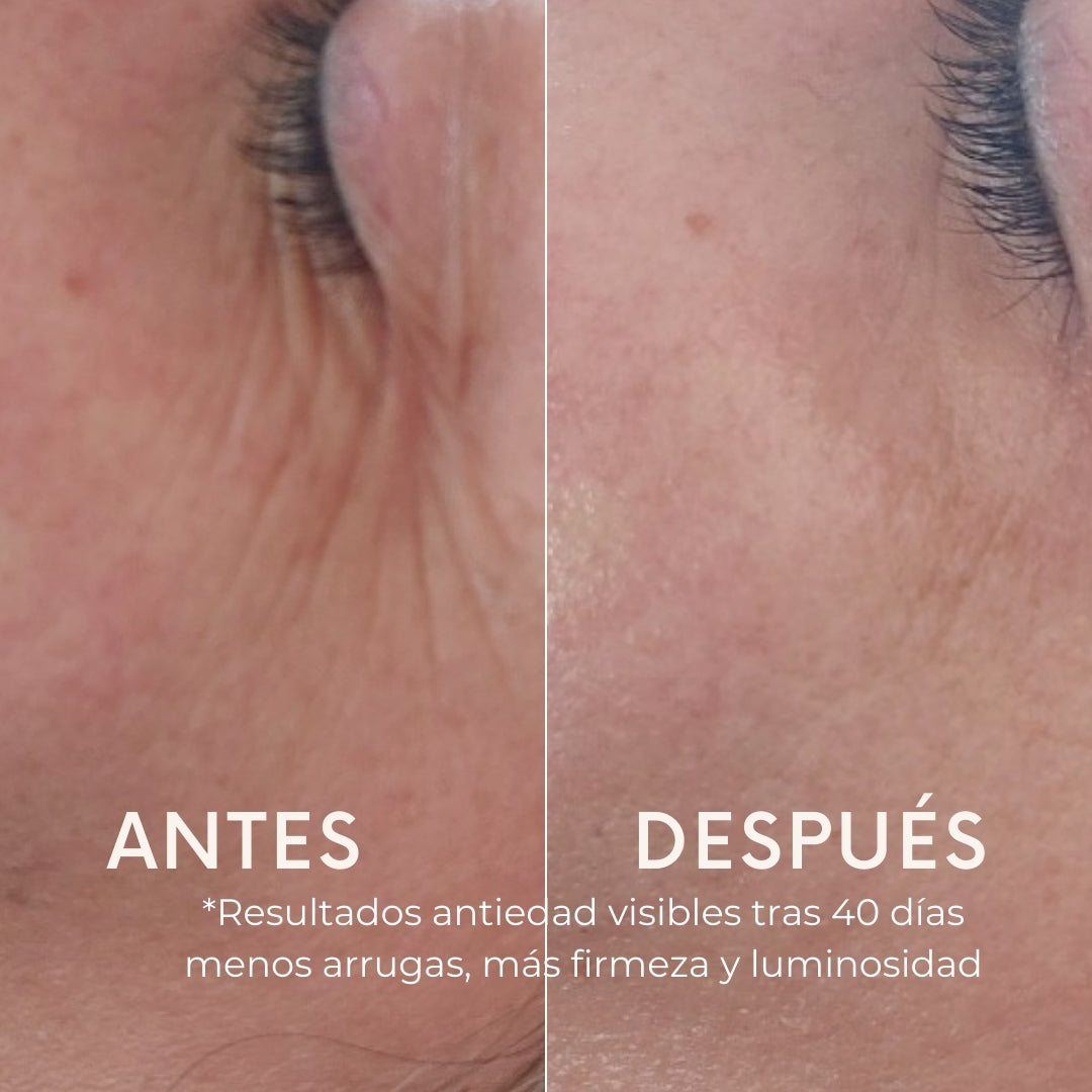 ¡Despierta cada mañana con buena cara, y piel radiante! 2 pasos, restaura de noche y protege de día.
Rejuvenece, Protege, Reduce los Poros, Consigue una Piel 2 veces más Luminosa desde la primera aplicación ¿A qué esperas?