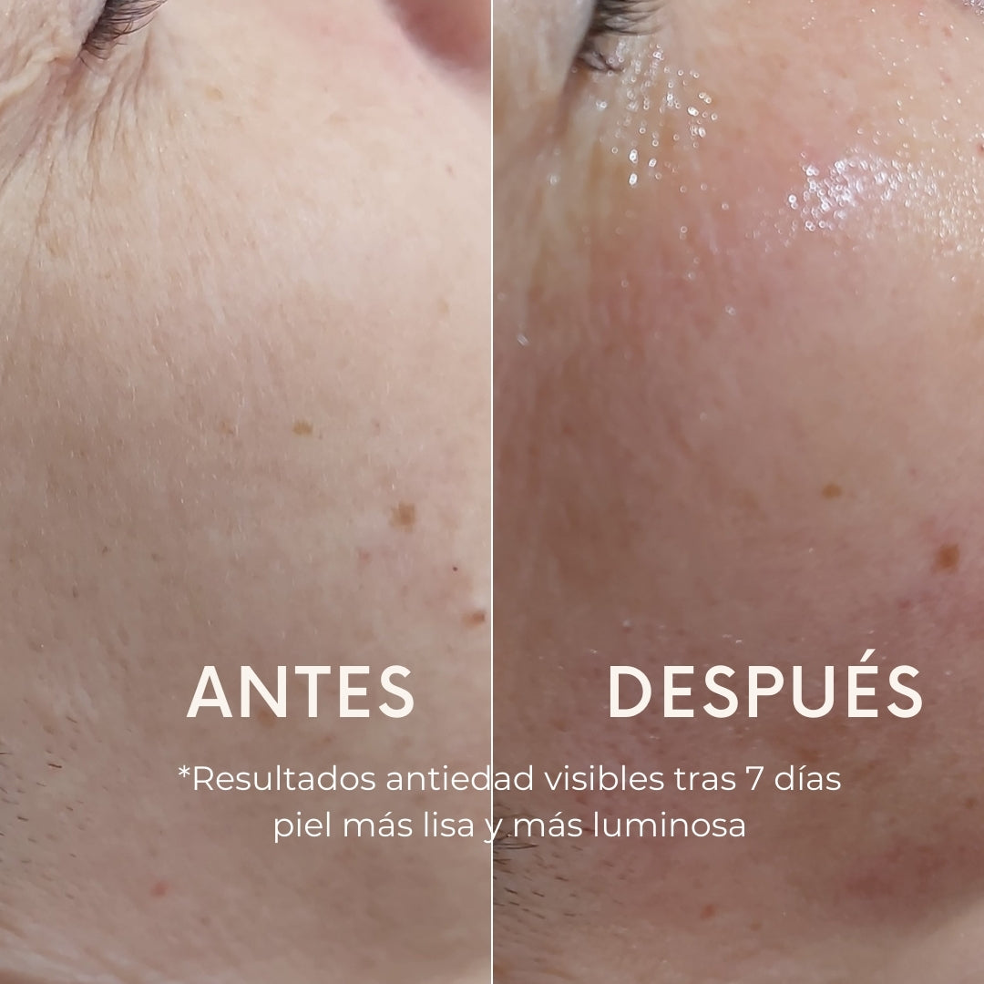 Tono de la Piel más Uniforme — Reduce los Poros - Reafirma - Rejuvenece, Consigue una Piel 2 veces más Luminosa y una apariencia más joven desde la primera aplicación.
Envejecimiento saludable, ¡Realza tu belleza natural! Cara, contorno de ojos, cuello y escote. 
2 pasos, reafirma, rejuvenece, aclara y previene manchas, unifica tono, aporta luminosidad e hidratación y suaviza poros.