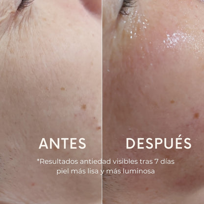 Tono de la Piel más Uniforme — Reduce los Poros - Reafirma - Rejuvenece, Consigue una Piel 2 veces más Luminosa y una apariencia más joven desde la primera aplicación.
Envejecimiento saludable, ¡Realza tu belleza natural! Cara, contorno de ojos, cuello y escote. 
2 pasos, reafirma, rejuvenece, aclara y previene manchas, unifica tono, aporta luminosidad e hidratación y suaviza poros.